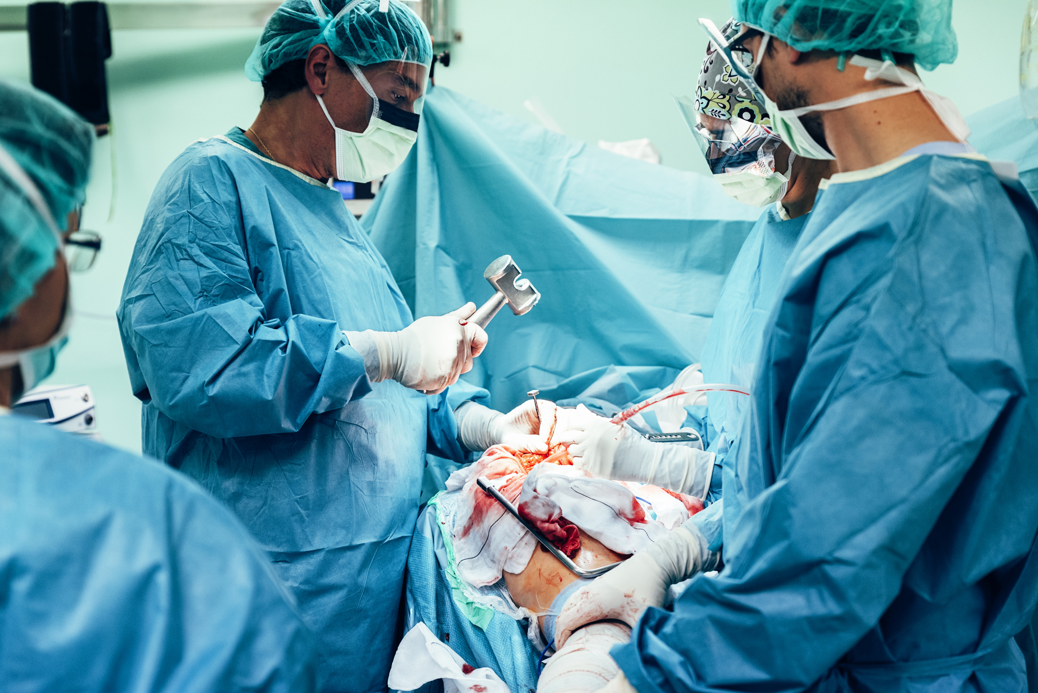 Team Of Surgeons Operating General Blog   Orthopedic Surgeon In Lahore 